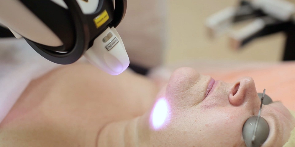 Nd YAP Q-switched emitētājs