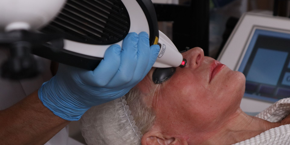 Ādas atjaunošana un liftings (RecoSMA® uz MULTILINE™ platformas)