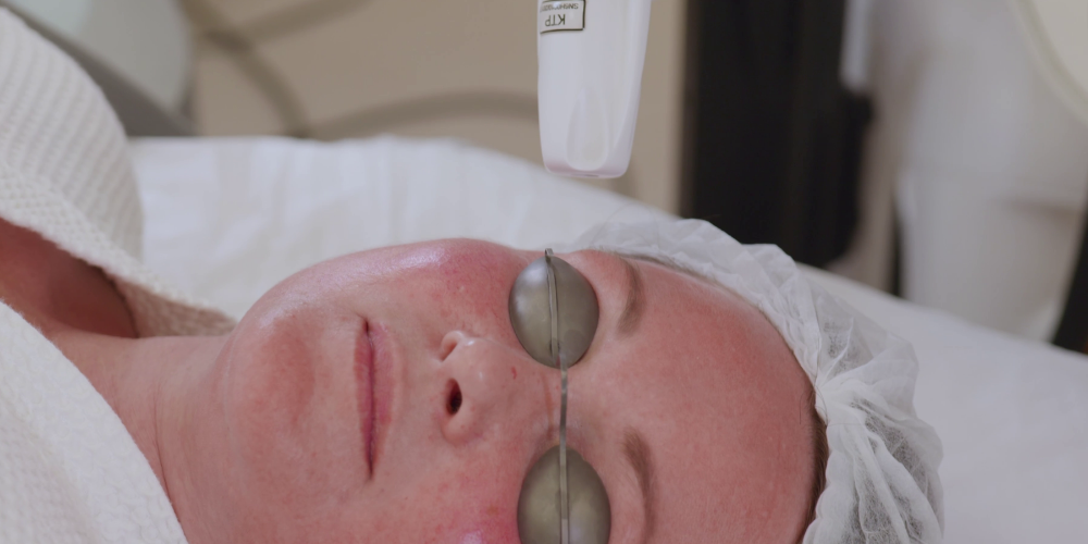 Nd YAP Q-switched emitētājs