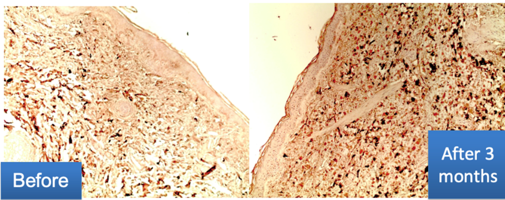 Imūnhistoķīmiskā izmeklēšana