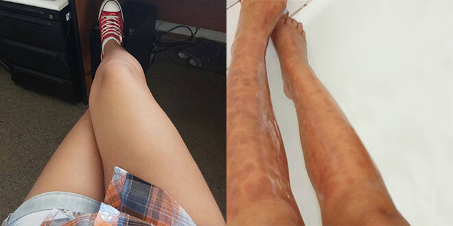 Eпилировать vai vienkārši arжечь?